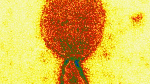 Crema News - E adesso c'è il LayV virus
