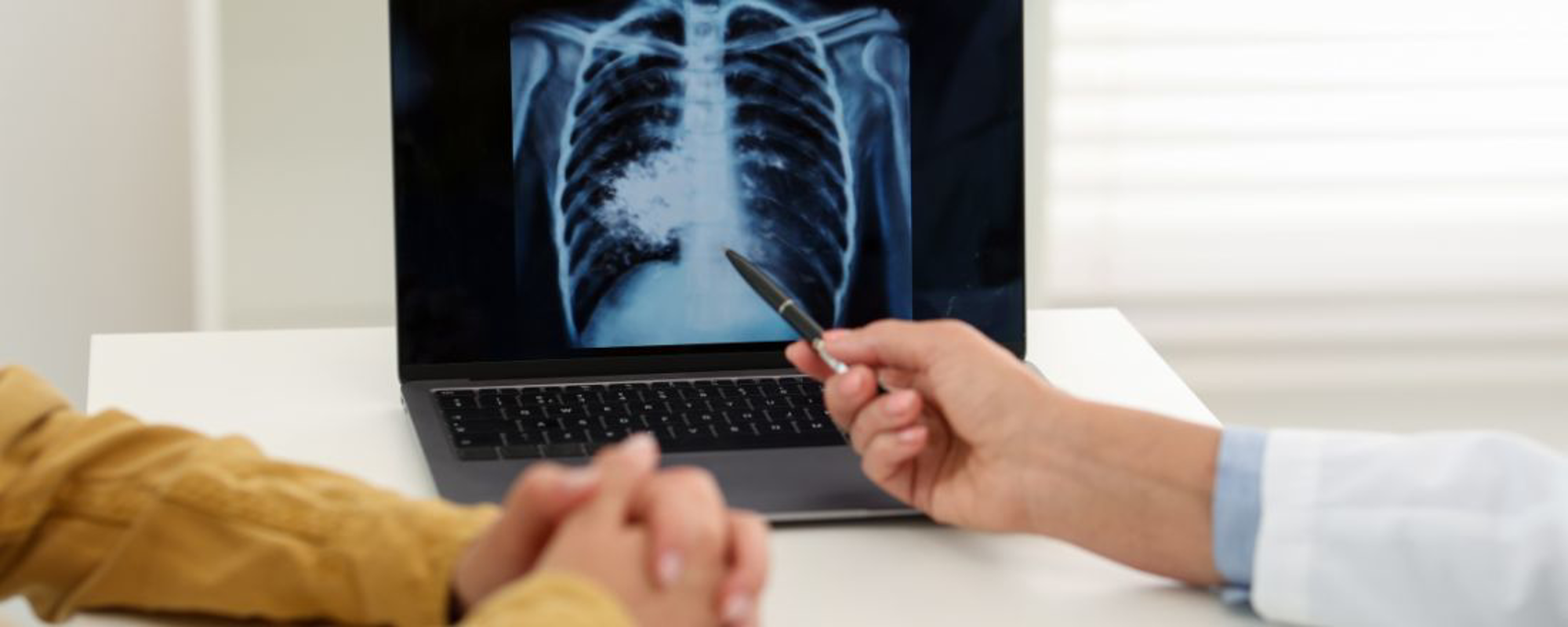 Pandino - Tubercolosi alla materna, tamponi in corso